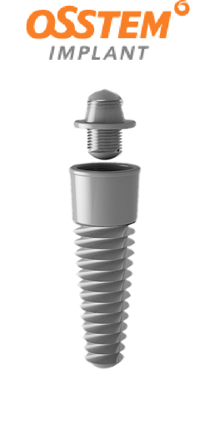 アジアシェアNo.1 オステムインプラント