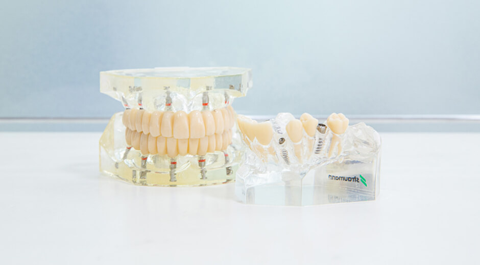 インプラント症例年間1000本以上。信頼の技術と実績。