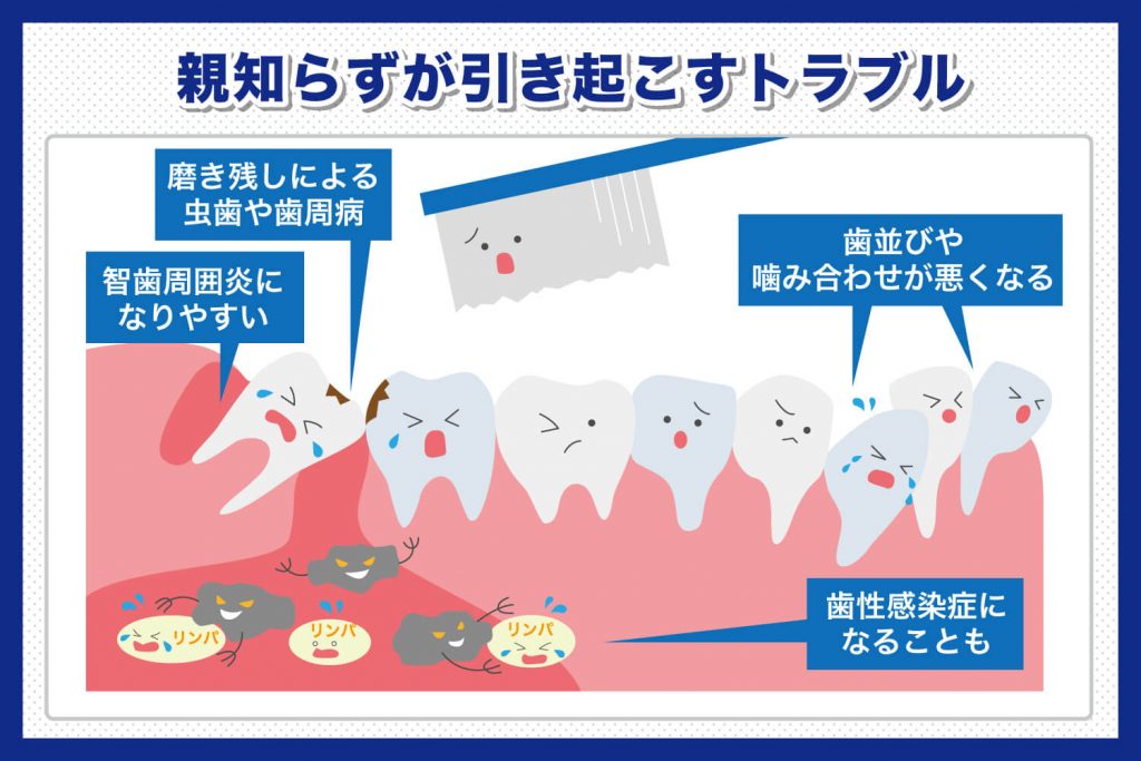 抜歯後のめまいを防ぐことはできますか?