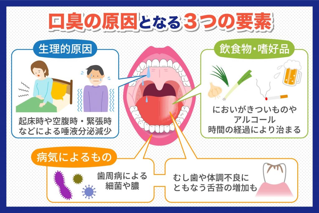 口臭の原因となる3つの要素