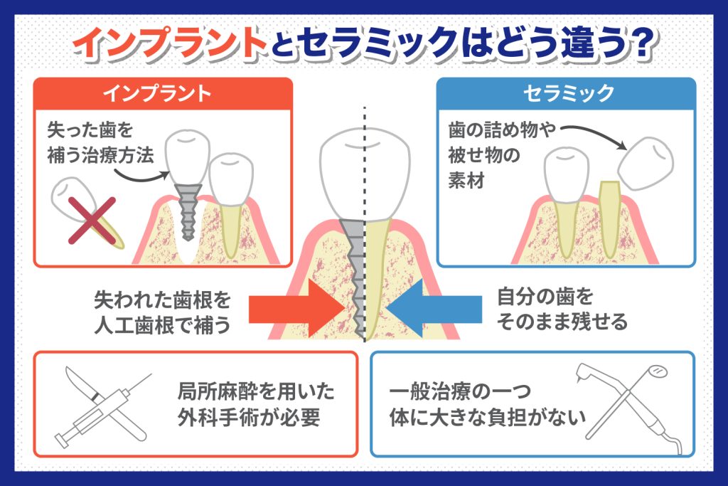 インプラントとセラミックの違い